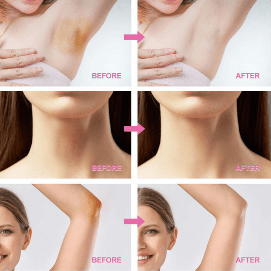 you bello Under arm Whitening cream