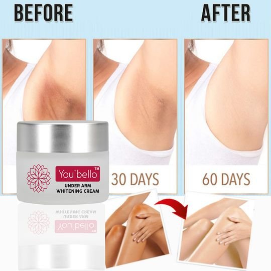 you bello Under arm Whitening cream